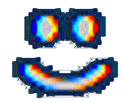 iVPeEcp.png